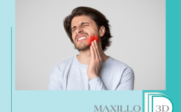 Les dents de sagesse : silencieuses mais pas toujours inoffensives