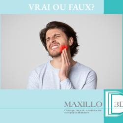 Les dents de sagesse : silencieuses mais pas toujours inoffensives