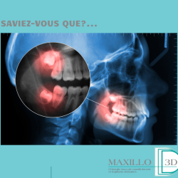 Saviez-vous que?…