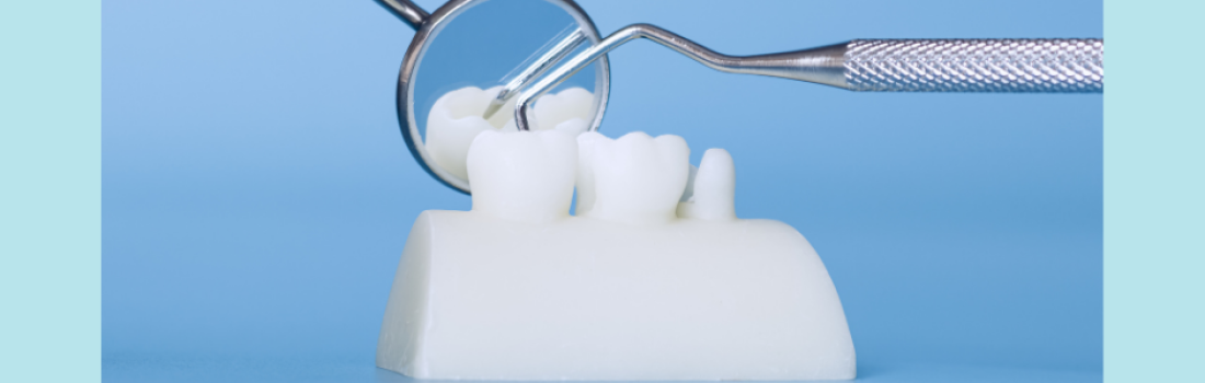 Commencez l’année en prenant soin de votre santé bucco-dentaire