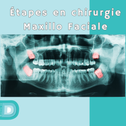 L’extraction des dents de sagesse