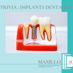 Trivia : Implants Dentaires