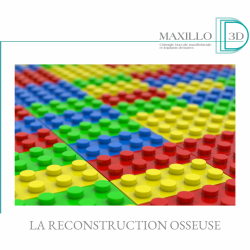 L’art de la reconstruction osseuse