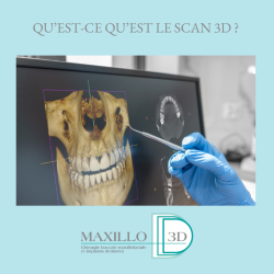 Quest-ce qu’un scan 3D ?