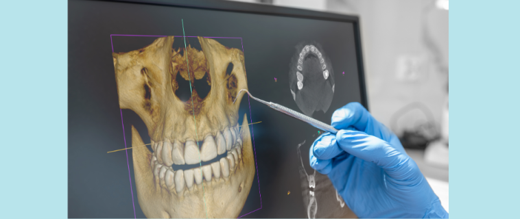 Quest-ce qu’un scan 3D ?