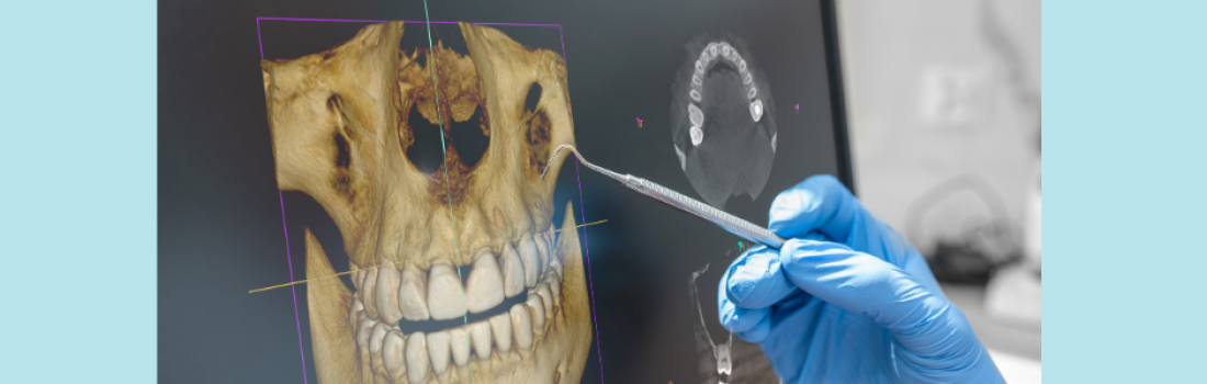 Quest-ce qu’un scan 3D ?